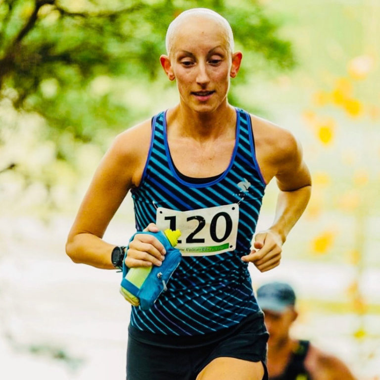 Lindsay Walter RADrabbit Ultra Runner Alopecia